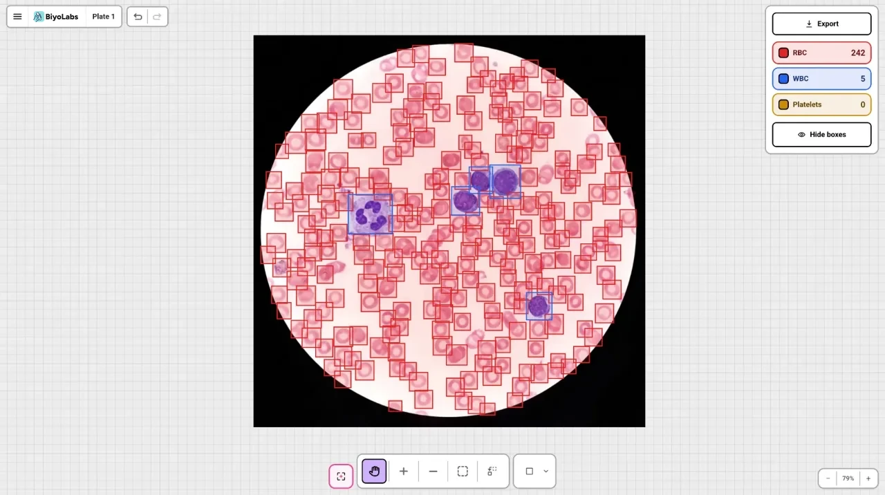 Example blood smear photo